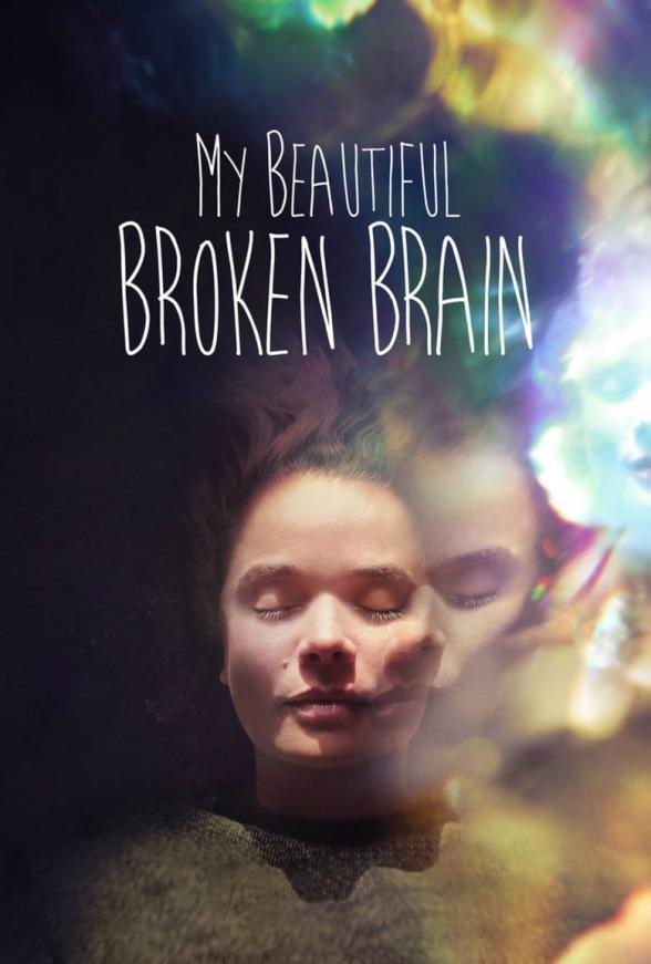 Poster image for MY BEAUTIFUL BROKEN BRAIN