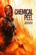 Poster image for CHEMICAL PEEL